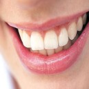 راههایی برای پیشگیری از پوسیدگی دندان